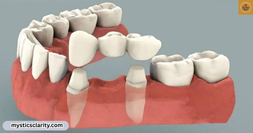 interpreting-dreams-about-wisdom-teeth